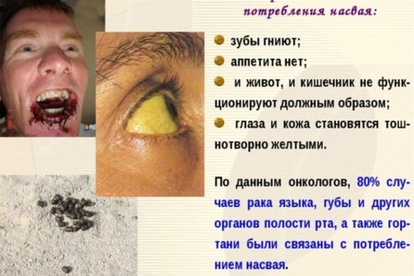 Что такое кракен сайт в россии